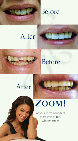 cortez dentist services